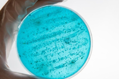 Европейский центр контроля заболеваний заявил о распространении опасного грибка Candidozyma auris (C