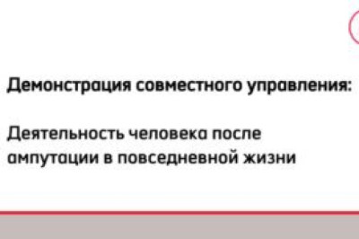 Инженеры создали бионическую руку с искусственным разумом